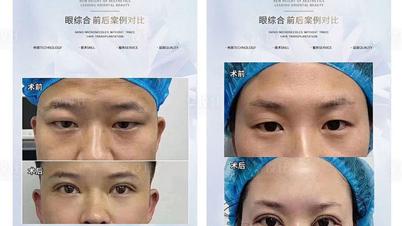 小标题：了解禁忌，安全塑美