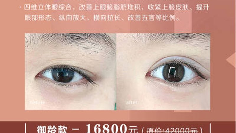 双眼皮手术费用揭秘：了解价格背后的真相