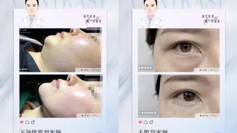 美容仪抗衰后需要敷面膜吗