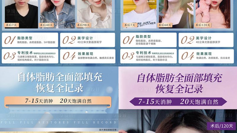 医美咨询师案例分享注意事项
