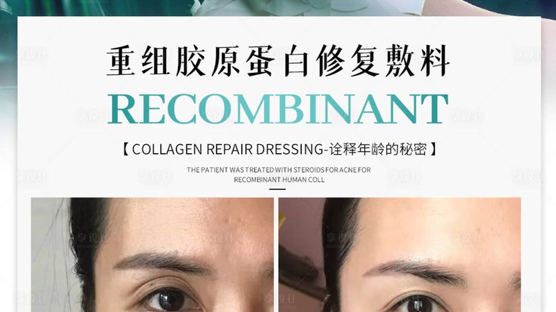 家用激光脱毛仪器：揭秘定制背后的技术奥秘