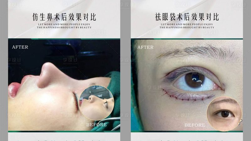 热玛吉探头真假难辨？揭秘鉴别方法，避免上当受骗