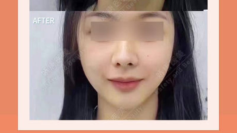 医美咨询师公司代理：揭秘行业合作背后的关键要素