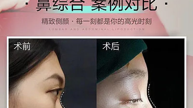 抗衰加盟代理适合新手吗