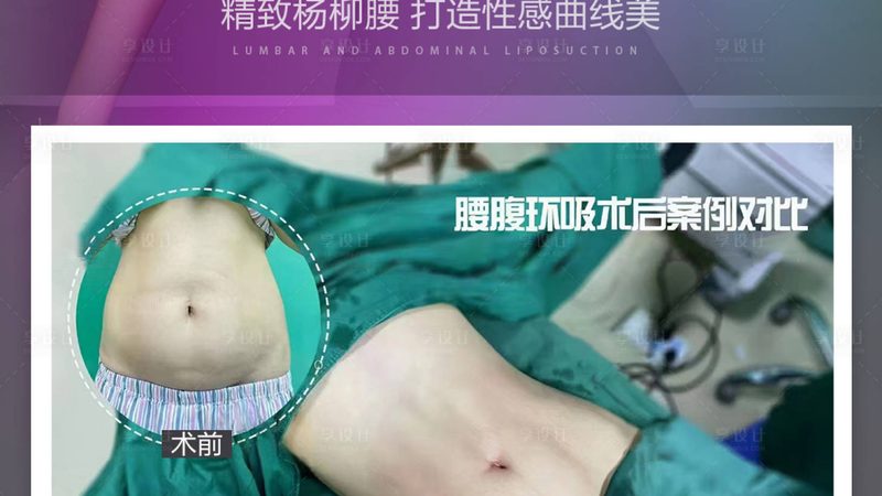 热玛吉五代与四代的价格差，到底值不值