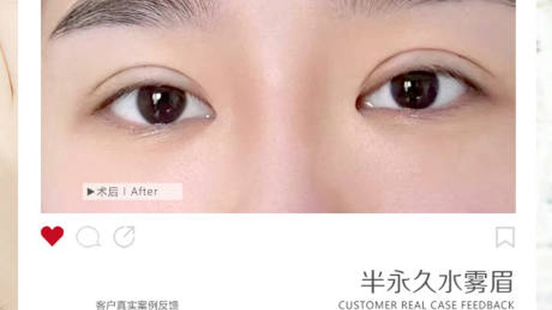 成都瘦脸定制方案怎么选