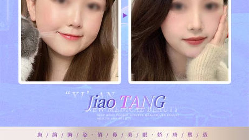 超声炮美容院设备：揭秘性价比之选