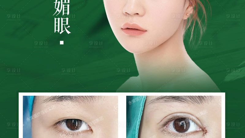 激光祛斑效果能维持多久？揭秘祛斑后的长效保持秘诀