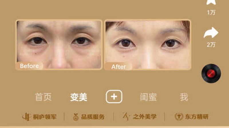 激光美容加盟，效果如何？揭秘加盟背后的真相