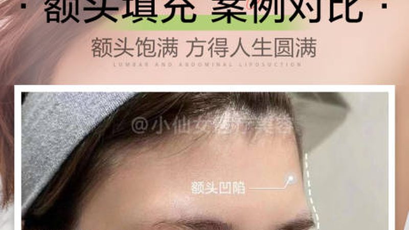 光子嫩肤后的皮肤修复周期一般为3-4周，期间需要注意以下几点：