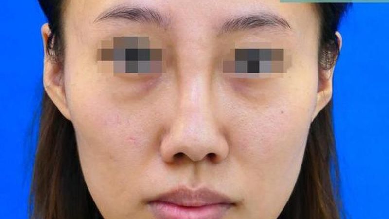 医用注射美容操作规范手册：安全塑美的关键指南